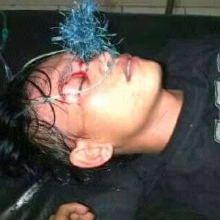 Korban baru Baru PANAH WAYAR di Manado
