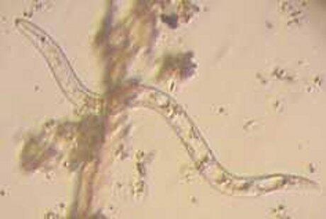 DANGEROUS WORMS FOR HUMAN ALIAS CACING YANG BERBAHAYA GAN