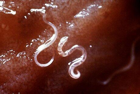 DANGEROUS WORMS FOR HUMAN ALIAS CACING YANG BERBAHAYA GAN