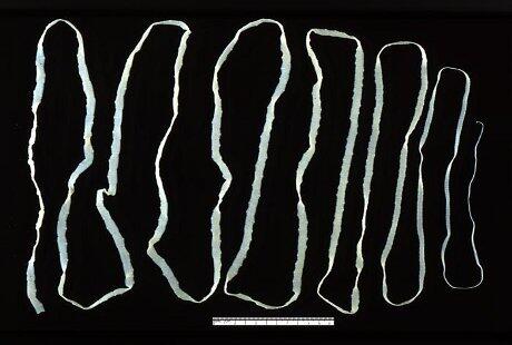 DANGEROUS WORMS FOR HUMAN ALIAS CACING YANG BERBAHAYA GAN