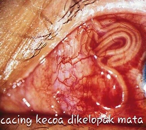 BAHAYA MEMBUNUH KECOAK