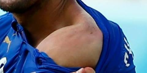 Lagi, Suarez menggigit pemain Italia di world cup 2014! &#91;+Pict&#93;