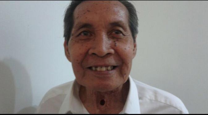 Leher Pria Ini Bolong Gara-gara Rokok