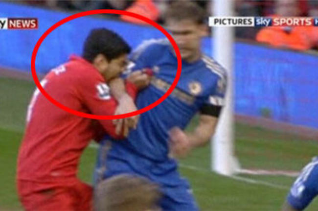 Gigitan suarez makin extrem dari pada Sinetron
