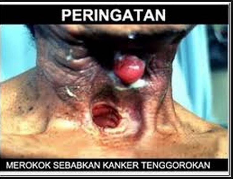 sisakan 1 batang