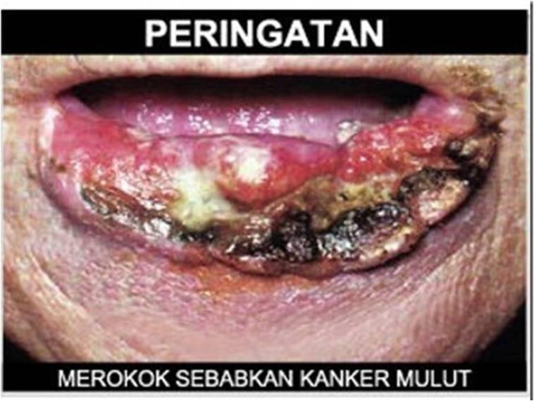 sisakan 1 batang