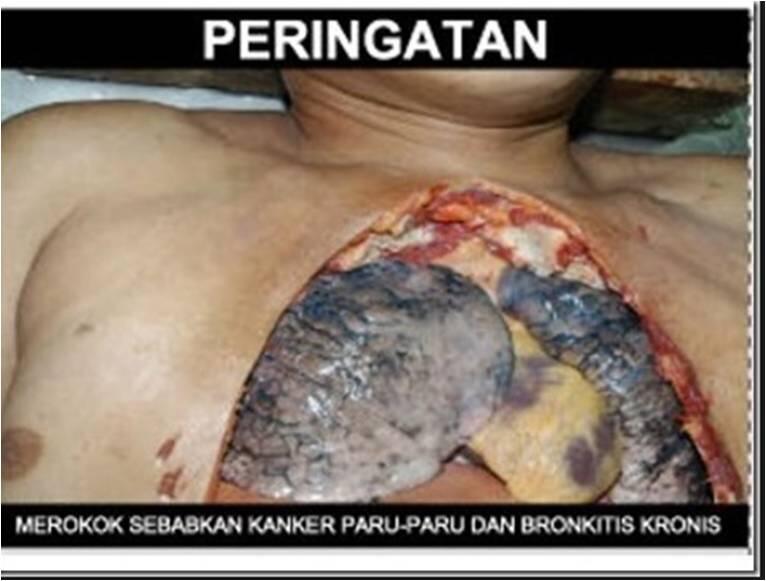 sisakan 1 batang