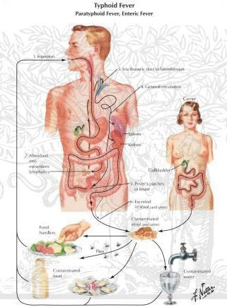 OBAT HERBAL TYPUS