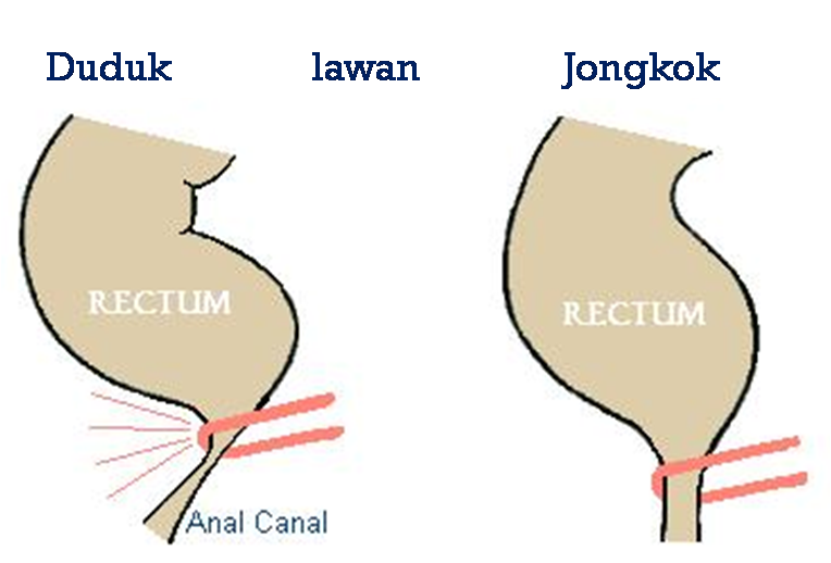 Pengalaman pake kloset duduk sampai pup beralatan kemana mana