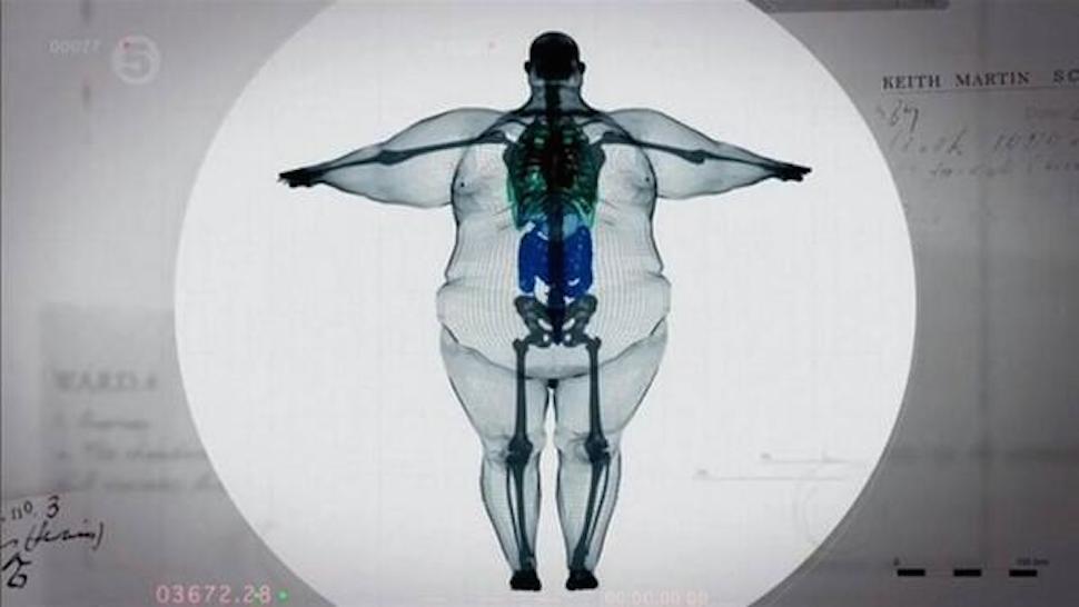 GAMBAR HASIL X RAY YANG PALING MENCENGANGKAN