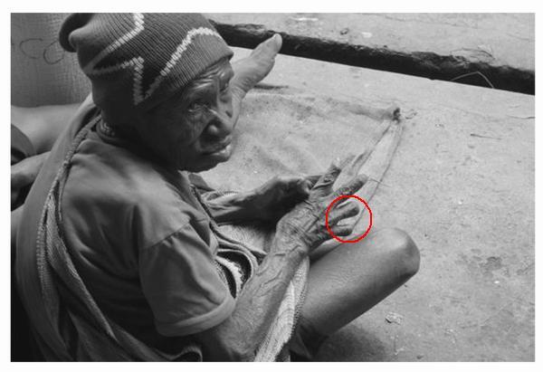 Tradisi Potong Jari di Papua