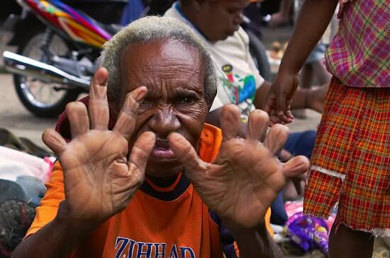 Tradisi Potong Jari di Papua