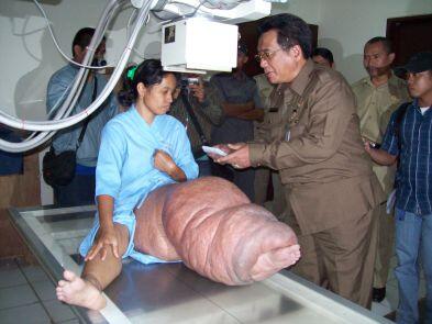 Laboratorium Amerika Kembangkan 324 Senjata Biologis