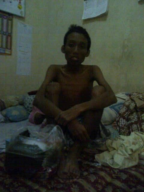 &#91;Bantuan Dana&#93; untuk Saudara kita Rengga Bartolomeus Putra