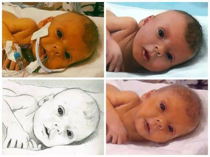 Bayi ini hidup tinggal 6 minggu lagi karna tumor hati dan ...