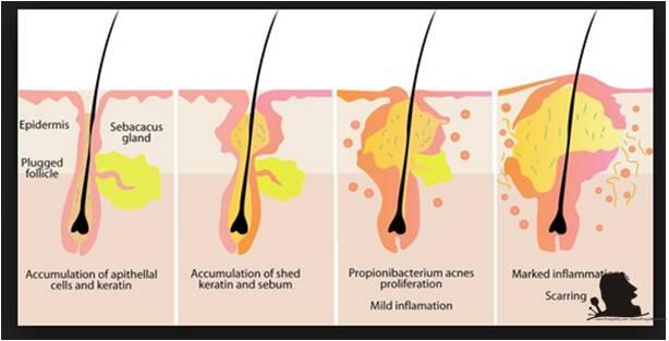 &#91;Konsultasi&#93; Permasalahan seputar kecantikan dan perawatan wajah