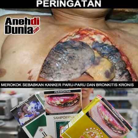 PERINGATAN BAHAYA MEROKOK DENGAN GAMBAR