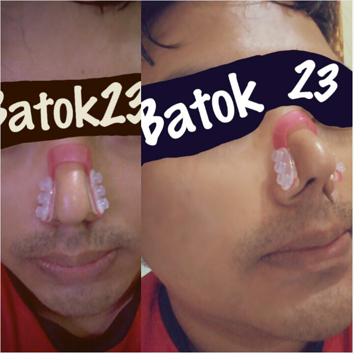 Dari Mata Turun Ke Hidung
