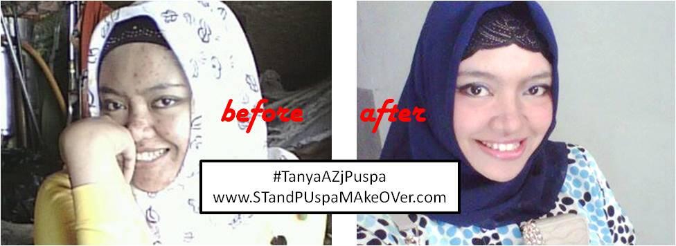 &#91;Konsultasi&#93; Permasalahan seputar kecantikan dan perawatan wajah