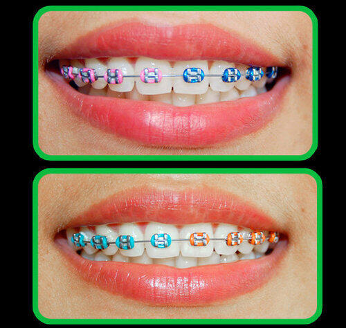 BEHEL FASHION ORIGINAL (LEPAS - PASANG )