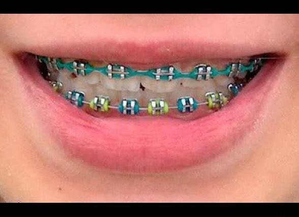 BEHEL FASHION ORIGINAL (LEPAS - PASANG )