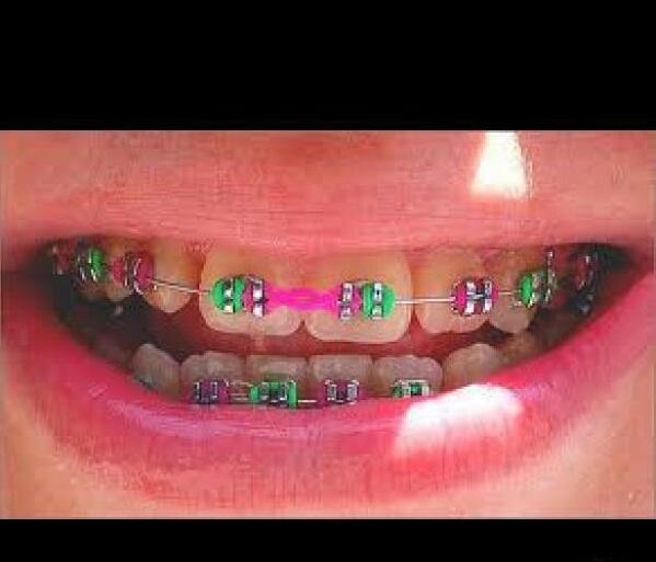 BEHEL FASHION ORIGINAL (LEPAS - PASANG )