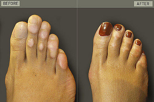&#91;Gokil&#93; Demi cantik, jari kaki pun di potong. 
