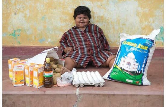 Perempuan 9 Thn, BB 92 Kg, Seminggu Melahap 14 Kg Beras, 8 Kg Kentang, Ratusan Pisang