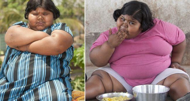 Perempuan 9 Thn, BB 92 Kg, Seminggu Melahap 14 Kg Beras, 8 Kg Kentang, Ratusan Pisang