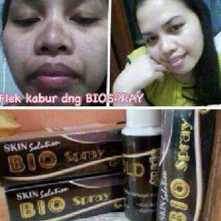 BIOSPRAY GOLD - 100% alami - produk booming^^ join skg juga