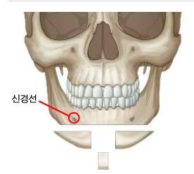 &#91;SHARE&#93; SEKILAS INFO TENTANG OP-PLAS