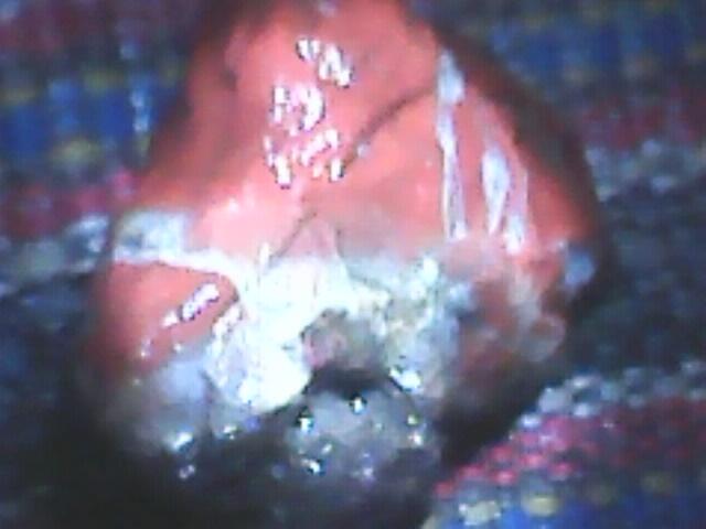 mohon bantu penjelasan tentang jenis batu cicin ini