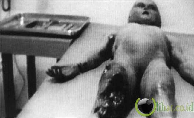 10 Foto Palsu (HOAX) yang pernah Menggemparkan Dunia 