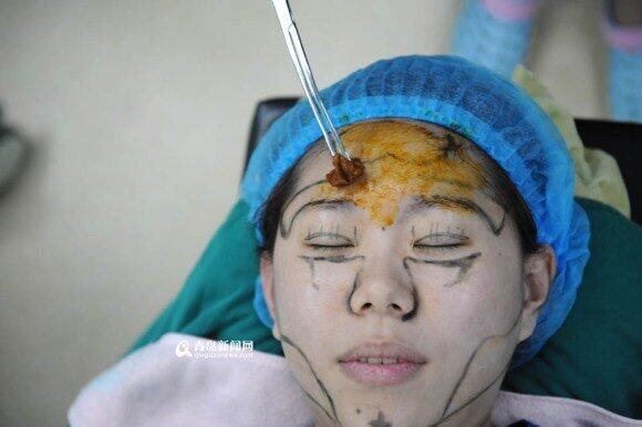 Muak dengan Makeup, Wanita Ini Pilih Operasi Plastik