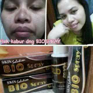 MSI Bio Spray Bisnis Modal Kecil Profit BESAR Real Bisnis