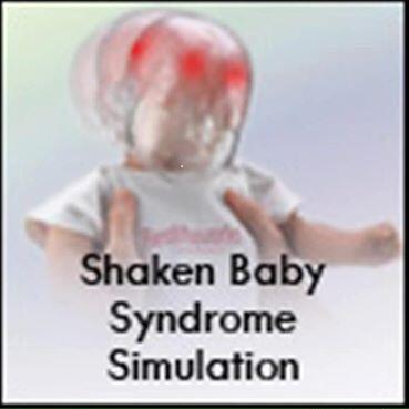 Shaken Baby Syndrome - Bahaya Mengguncang Tubuh Bayi