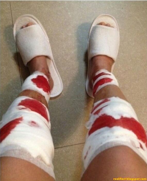 Mengerikan, Cara Menambah Ukuran Panjang Kaki Di Jepang