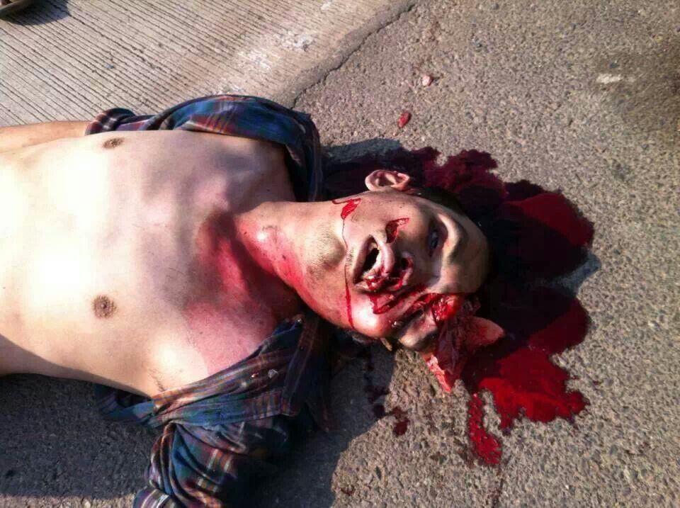 &#91;COMPILATION&#93; Kumpulan Foto Kecelakaan Brutal! Dijamin Muntah! (18+ Tahun)