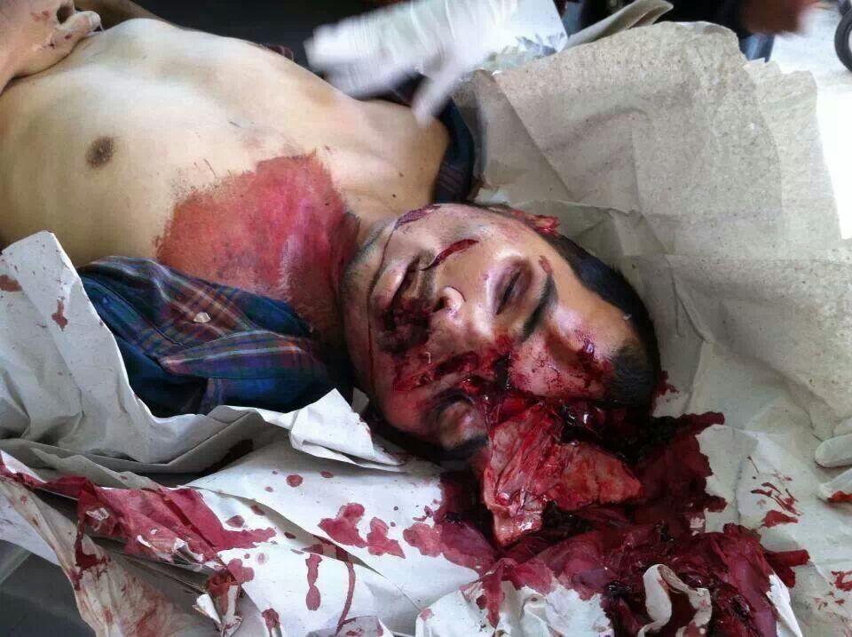 &#91;COMPILATION&#93; Kumpulan Foto Kecelakaan Brutal! Dijamin Muntah! (18+ Tahun)