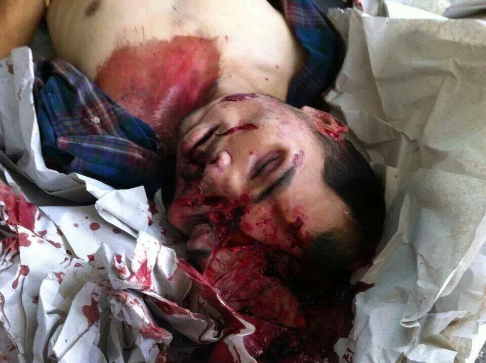 &#91;COMPILATION&#93; Kumpulan Foto Kecelakaan Brutal! Dijamin Muntah! (18+ Tahun)
