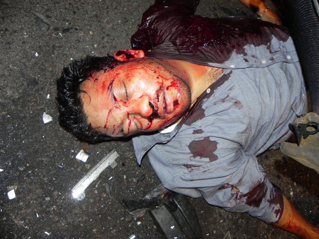 &#91;COMPILATION&#93; Kumpulan Foto Kecelakaan Brutal! Dijamin Muntah! (18+ Tahun)