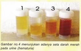 suka duka profesi "Analis Kesehatan"