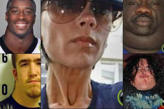 10 Orang yang Memiliki Leher Teraneh dan Terunik di Dunia