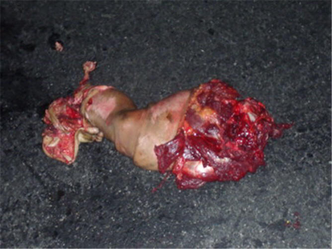 &#91;COMPILATION&#93; Kumpulan Foto Kecelakaan Brutal! Dijamin Muntah! (18+ Tahun)