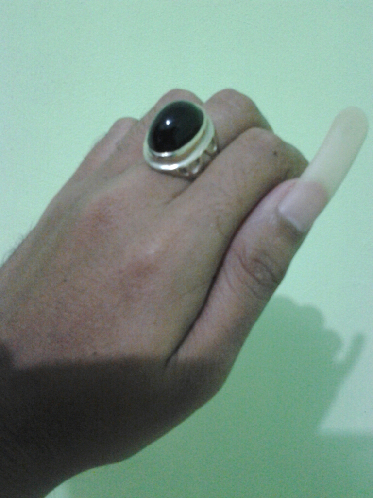 Yaman Cibeet Berminyak