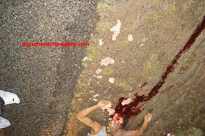 Pedestrian Walking Next to the Road Lost His Brains when a Schoolbus Hit Him