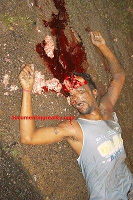 Pedestrian Walking Next to the Road Lost His Brains when a Schoolbus Hit Him
