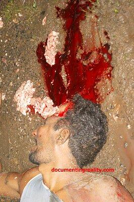 Pedestrian Walking Next to the Road Lost His Brains when a Schoolbus Hit Him