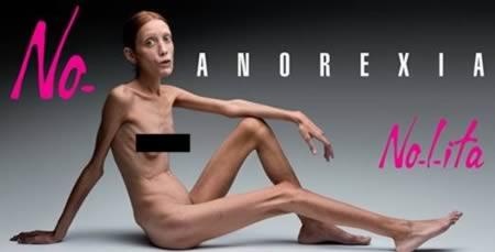 Tubuh Mereka Kurus Tinggal Tulang Belulang Akibat Anoreksia