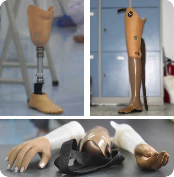 Prosthetics And Orthotics. Gan, Kenalan Ama Profesi Ini Biar Ga ...